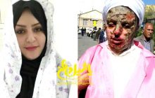 گفتگوی اختصاصی با زن ۲۶ ساله تبریزی که خواستگارش به صورتش اسید پاشید و دو انگشتش را با قمه قطع کرد