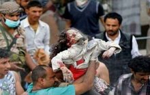 ۱۰۰ هزار حمله موشکی به یمن؛ جبهه متحد یمنی‌ها ضد متجاوزان