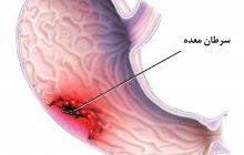 تغذیه مناسب را جدی بگیرید تا سرطان نگیرید / ۶ غذایی که نباید بخورید