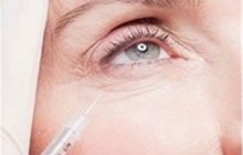 تزریق ژل و بوتاکس تا جراحی‌های پیشرفته با چاشنی باورهای غلط